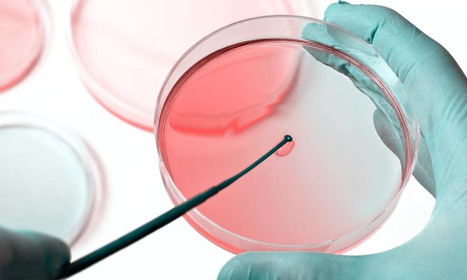Распознаю волосатую лейкопакию можно самостоятельно даже на ранних стадиях болезни