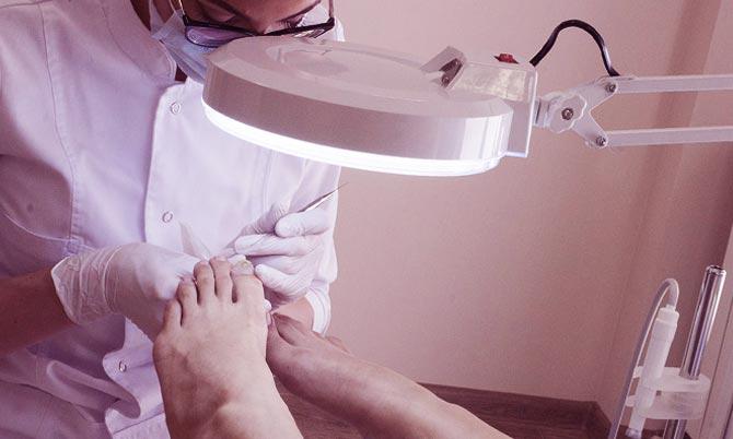 Дерматологическое заболевание грибок ногтей выявление дерматологом