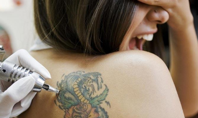 лазерное удаление татуировки | krasota.ru