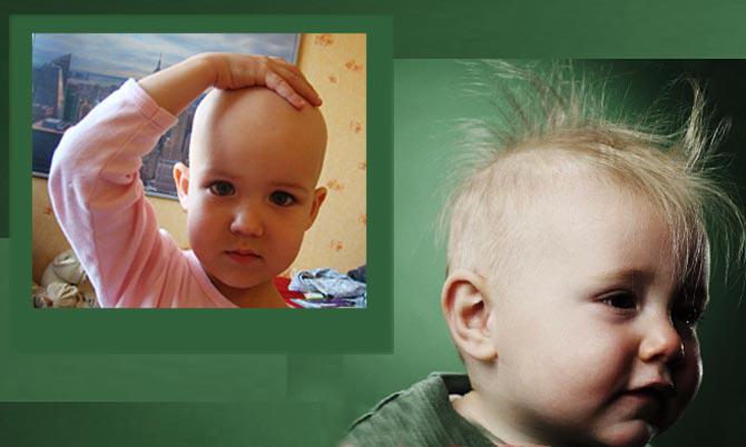 Существует много причин, по которым у детей могу выпадать волосы