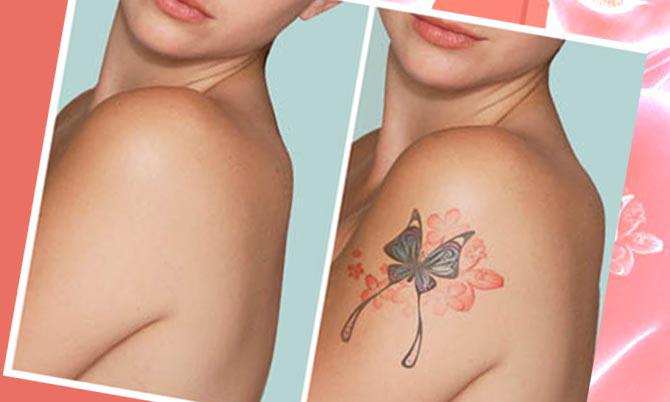 Удаление татуировки лазером в салоне Москвы | Красота.ру