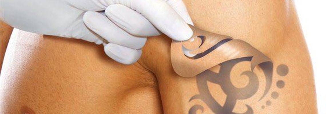 Удаление татуировок и перманентного макияжа лазером: особенности, преимущества и результат