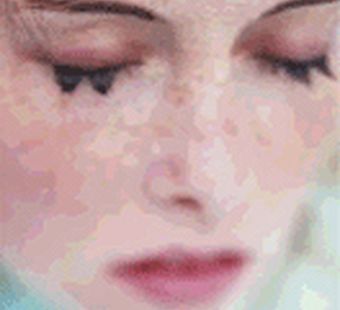 Как избавиться от веснушек?