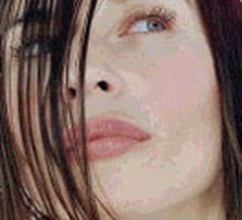 липофилинг -  косметическая коррекция лица