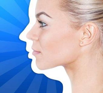 Липосакция второго подбородка лазером: особенности, плюсы и минусы процедуры