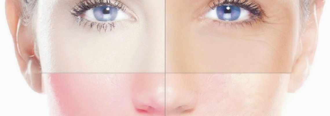 Фотопигментация и фототерапия: особенности, плюсы и минусы процедуры
