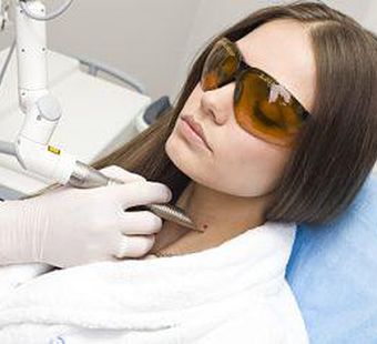 Удаление родинок и новообразований лазером: особенности процедуры